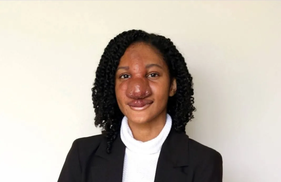 UWI Honours Student Alexia Trim Dies in Colombia