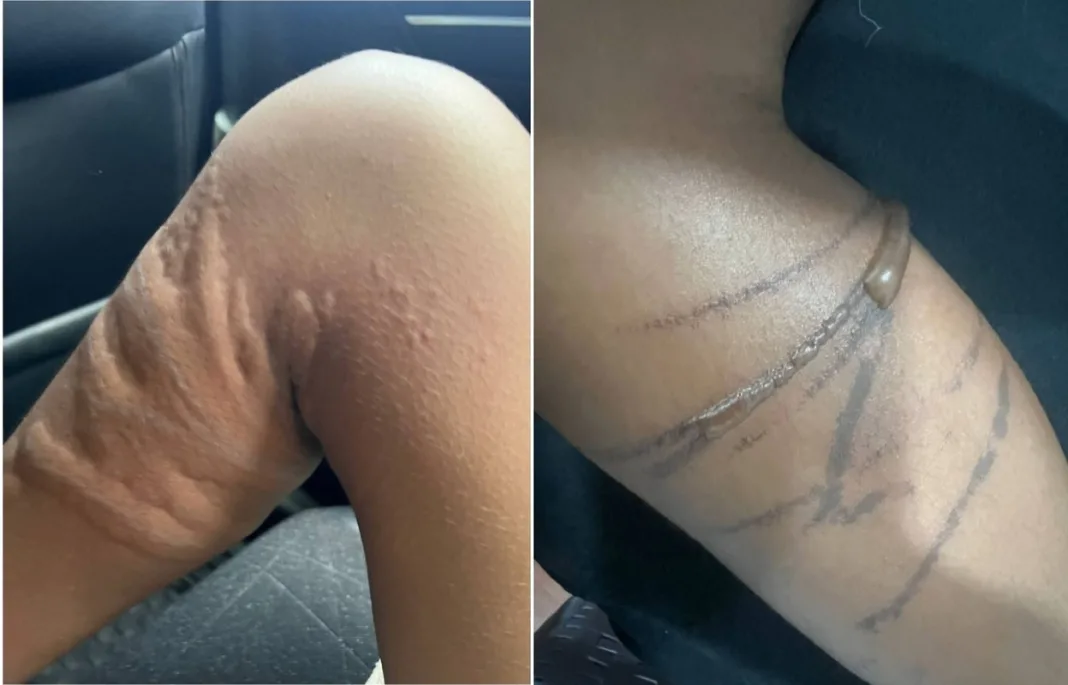 Mysterious ‘Brian’ Shoots Woman in Chaguanas Home Attack