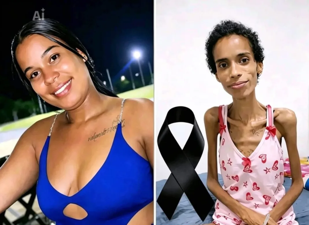Cancer-Stricken Emily’s Painful Account: The Underestimated Peril of Smoking