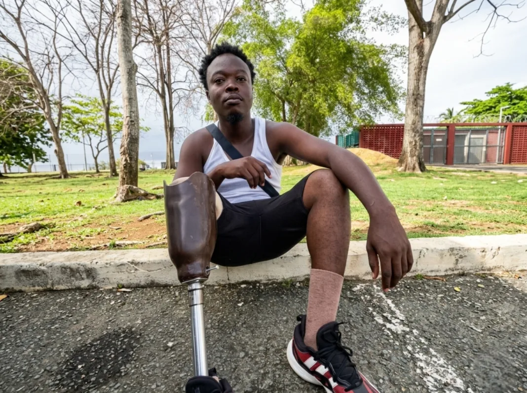 Tobago amputee says he survived on beach for two years.