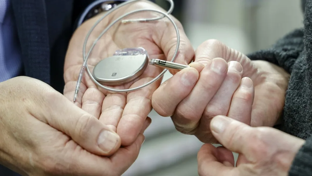 Two New Doctors Charged in Corpse Pacemaker Extraction Scandal