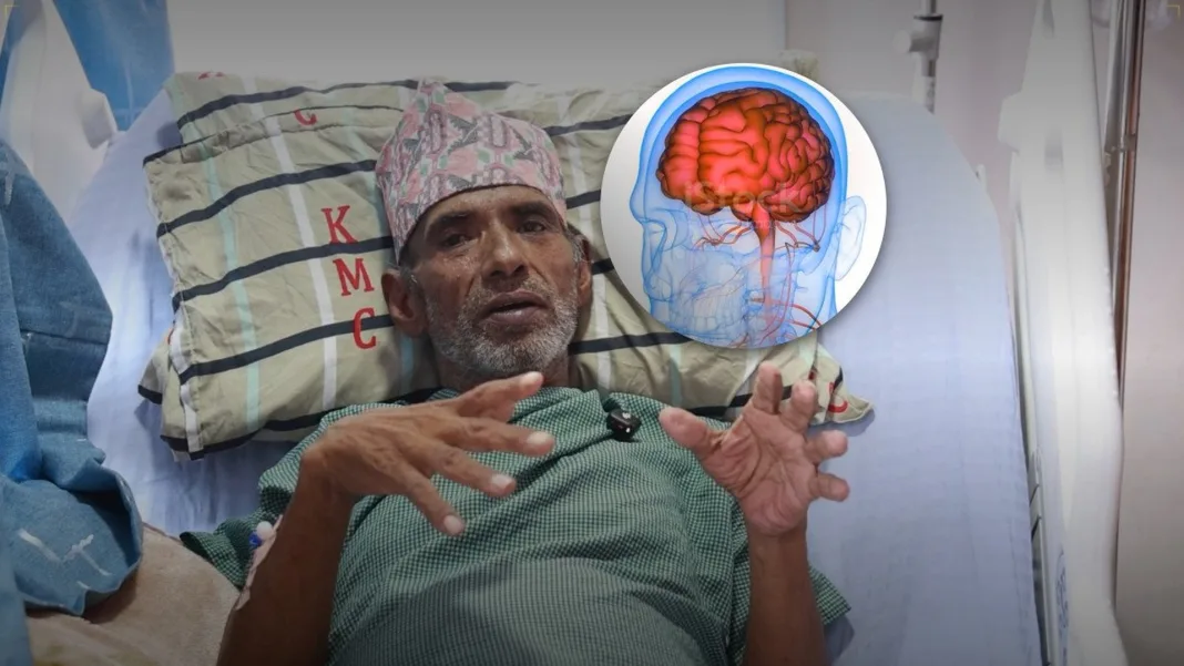 KMC Claims First Successful Non-Surgical Brain AVM Treatment in Nepal on 67-Year-Old