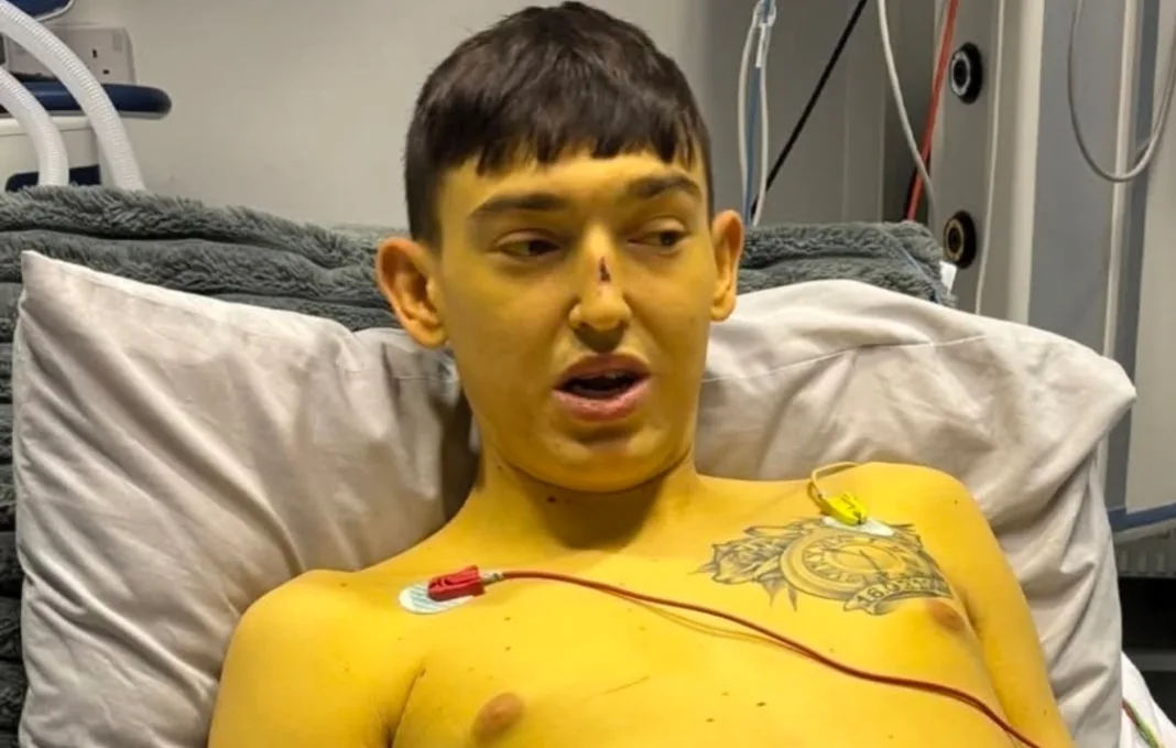Cheshire Man’s Skin Turns Yellow Before Life-Saving Liver Transplant