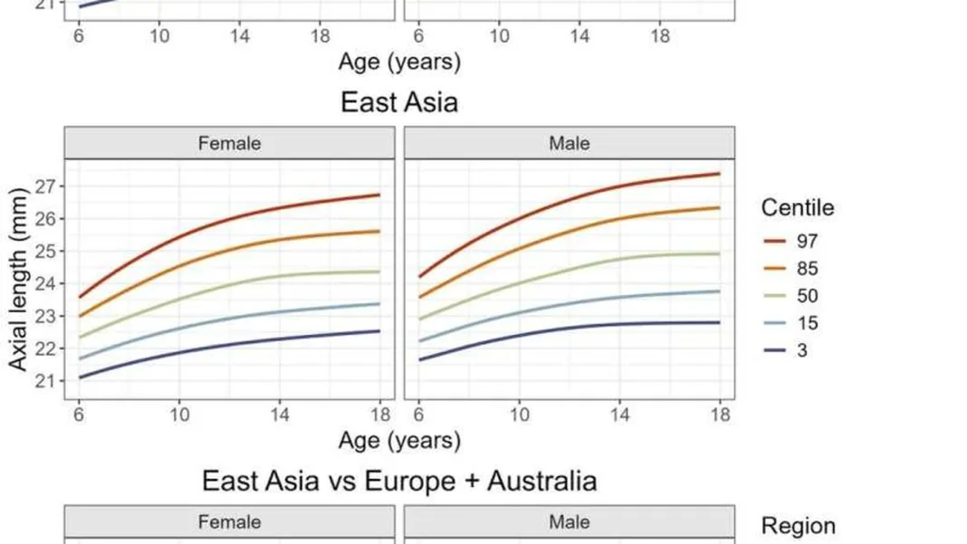 New eye growth charts could spot childhood myopia risk early