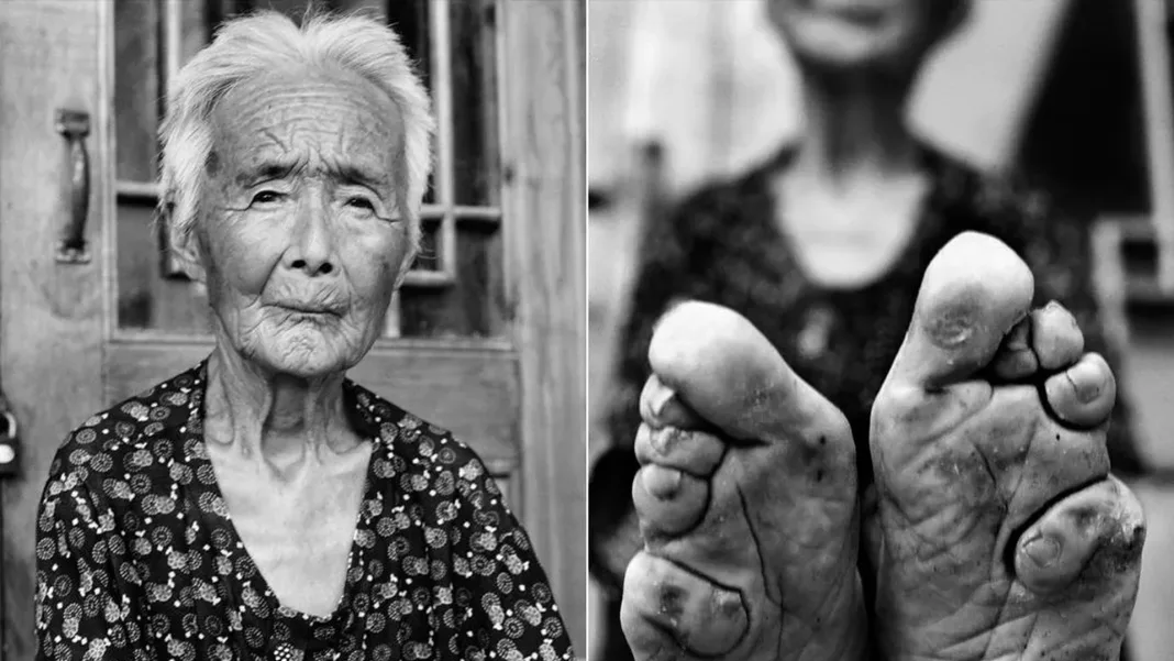 The Painful History of Chinese Foot Binding: Why Women Endured Years of Suffering for ‘Golden Lotus’ Feet