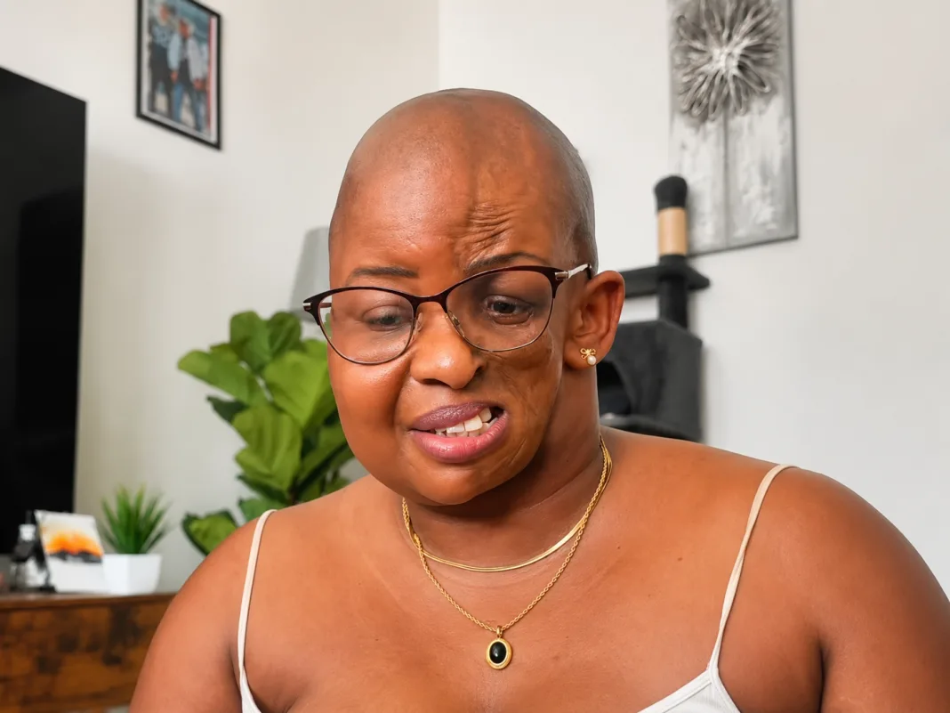 Teacher Called My Facial Condition ‘Witchcraft,’ Woman Recalls Painful Childhood Experience