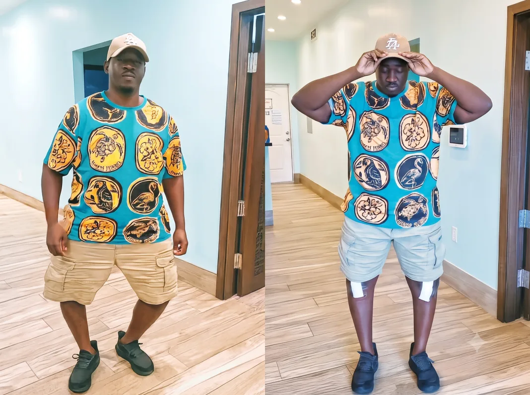 Grand Bahama Man’s $100k Surgery Transforms Life After Decades of Pain and Ridicule