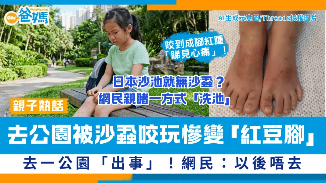 小朋友被蝨咬慘變「紅豆腳」！ 去這個公園玩樂設施「出事」網民：「以後唔去」
